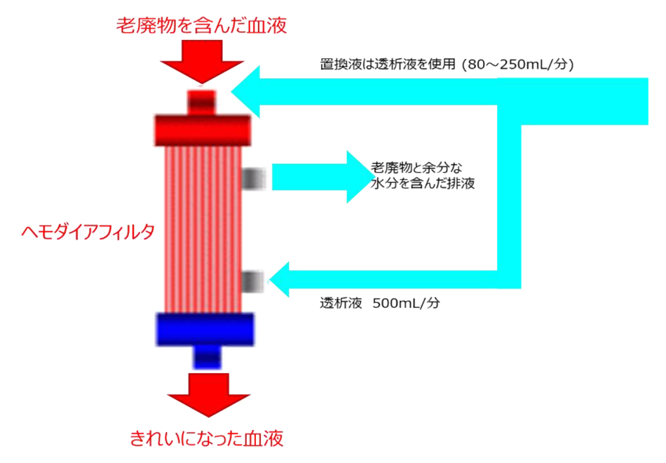 図1C. 血液濾過透析の方法