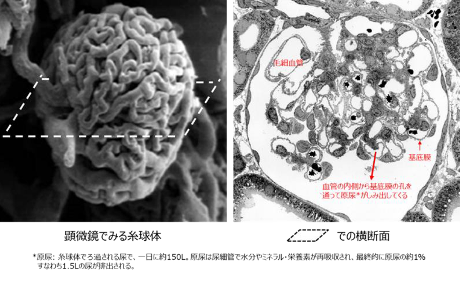 図2.顕微鏡でみる糸球体の構造
